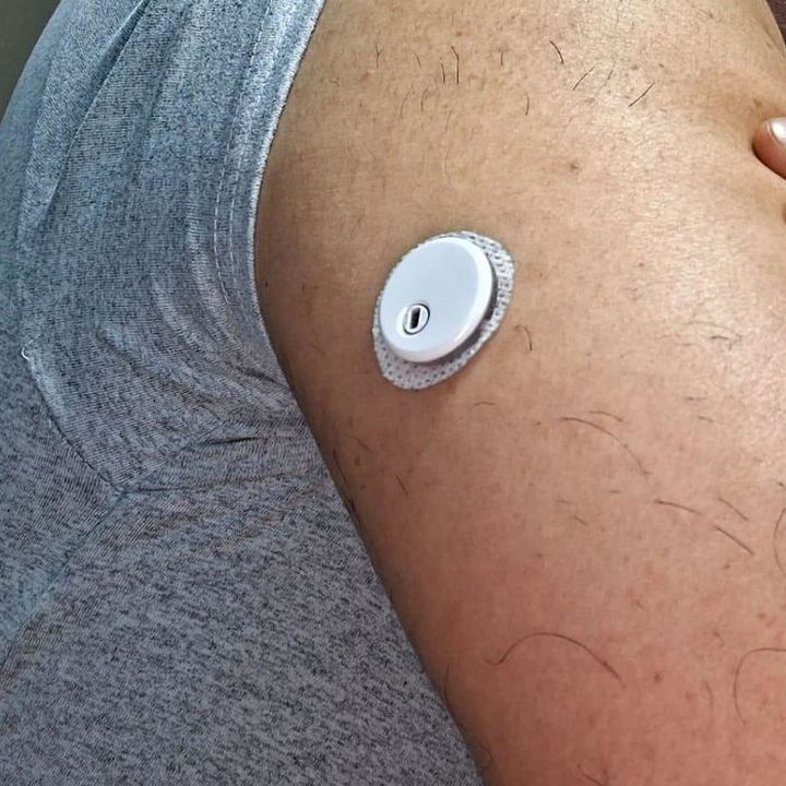 Foto de un cliente: el sensor QiTrax en su brazo