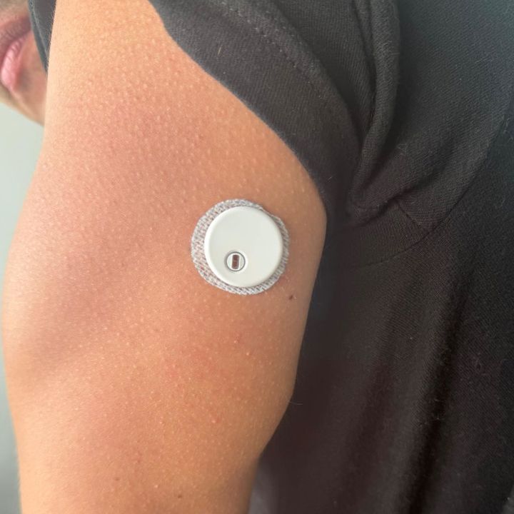 Foto de un cliente: el sensor QiTrax en su brazo