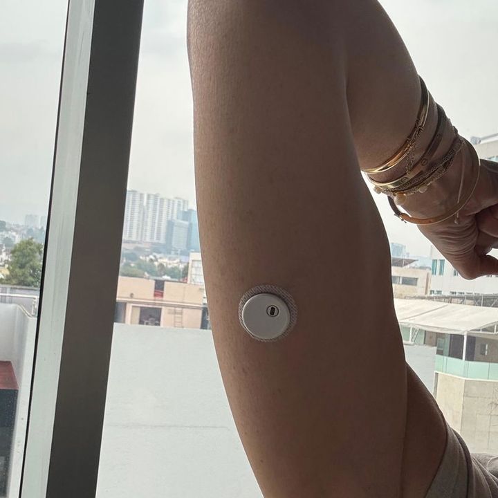 Foto de una clienta: el sensor QiTrax en su brazo, junto a una ventana